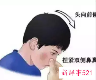 盐水洗鼻子流鼻血