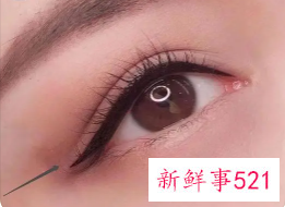 美瞳线后1至7天的变化图