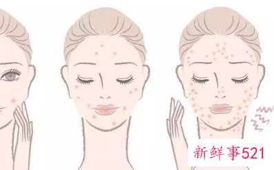 敏感肌会不会变成激素脸