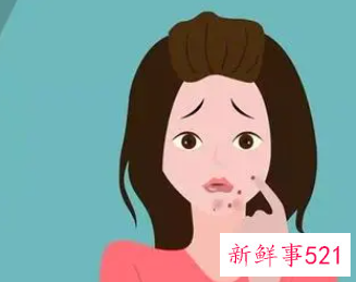 鼻翼长痘与卵巢吗