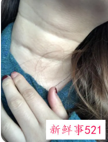 女子颈纹太深说明什么