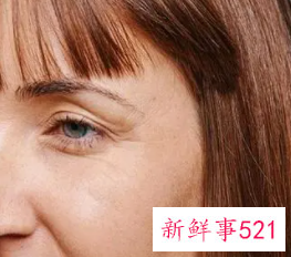 什么去皱纹最快