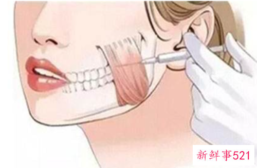 怎样瘦咬肌最快