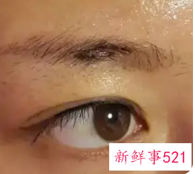 眉毛反色期可以敷面膜吗