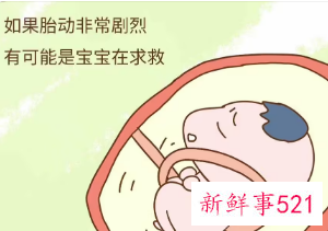 胎动分为哪些类型