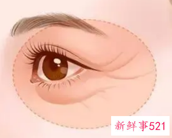 眼部拔筋有什么效果