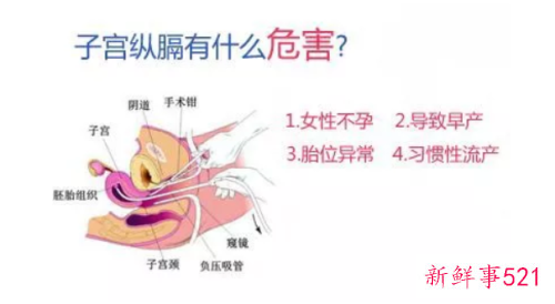 子宫纵隔为什么怀孕难