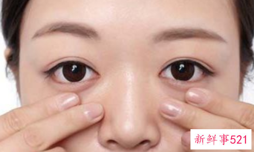 眼袋怎么消除简单方法有哪些