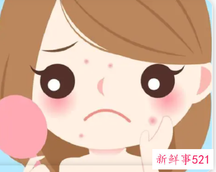 适合学生的祛痘办法