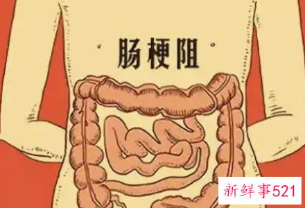 先天性肠道梗阻的症状有哪些