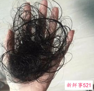 产后脱发严重怎么办呢