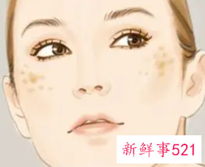 脸上的色斑是什么
