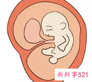 怀孕5个月可以同房有影响吗