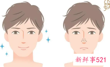 男生脸黑怎么变白最有效的方法