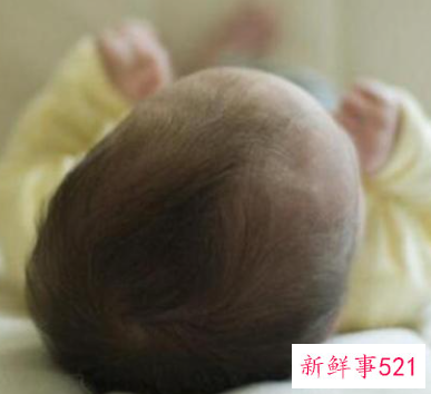 新生儿头歪向一侧