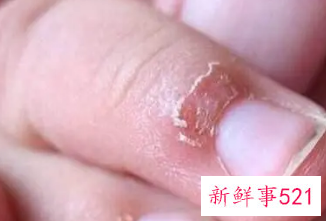 孩子老是啃手指头怎么办