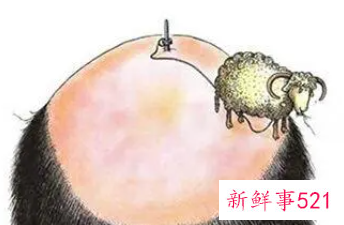 植发的风险与危害