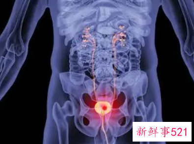 男性性功能障碍检查哪些项目