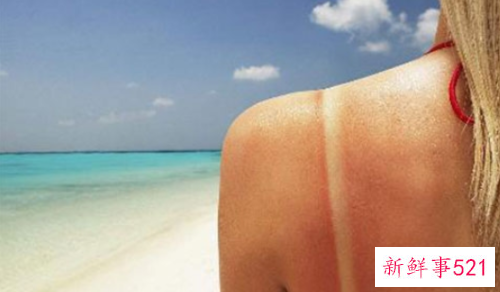 夏季让我们一起来阻击紫外线过敏