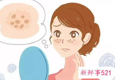 太阳晒出斑怎么办