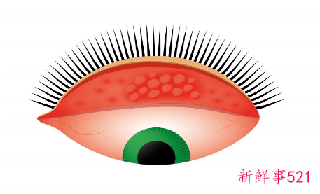 眼部拔筋有什么效果