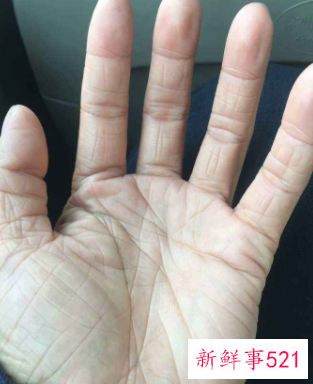 从小手就粗糙干燥皱纹多