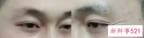 怡玥祛皱效果怎么样