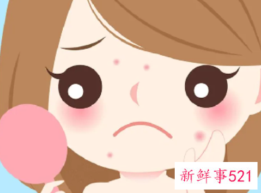 祛痘印的日常方法有哪些