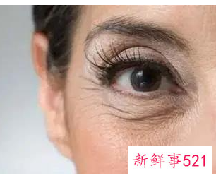 皱纹和干纹怎么区分