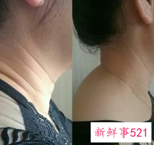 女子颈纹太深说明什么