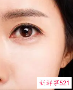 眼皮下垂怎么改善最有效