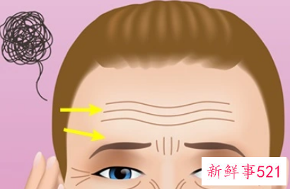 脸上的皱纹怎么能快速的处理掉