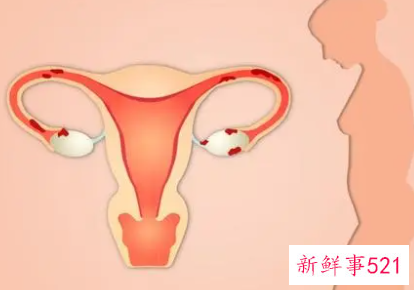 女人如何降低雌激素