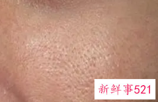 女性脸干燥怎么调理