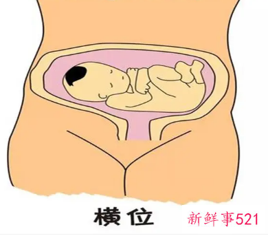 胎位不正每天跪最佳时间