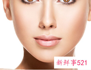 全脸脂肪填充案例