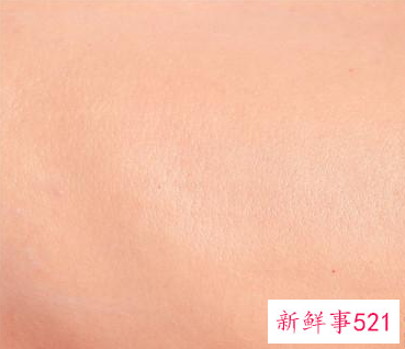 身上皮肤干燥起皮的原因