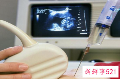 做羊水穿刺疼吗