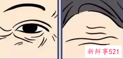 眉头皱纹怎么消除简单方法