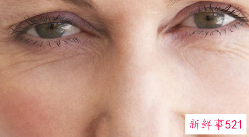 怎样让脸没有皱纹