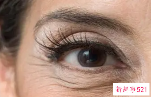 怎样让脸没有皱纹