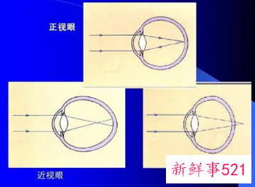 眼睛的基本知识大全