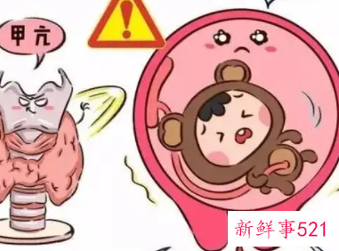 产后甲亢能自愈吗