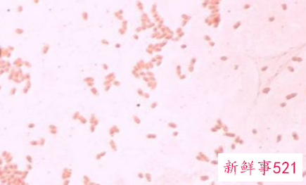 大肠杆菌是什么