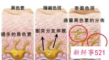 皮肤基础护理指什么