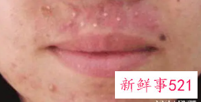 如何才能不做斑女郎拥有嫩白瓷肌呢美容