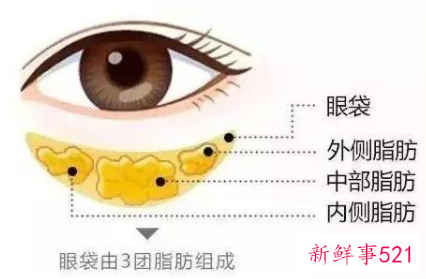 如何去除眼袋最有效