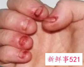 孩子老是啃手指头怎么办