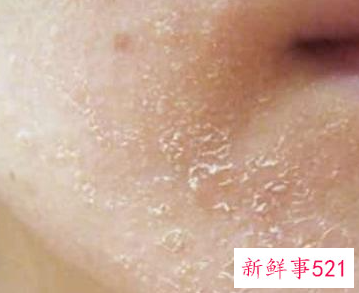 怎样给脸部补水最有效