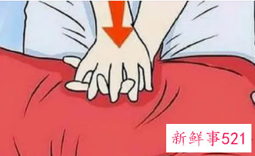 心肺复苏压断肋骨需不需要赔偿